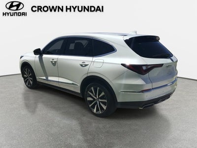 2025 Acura MDX Technology Package
